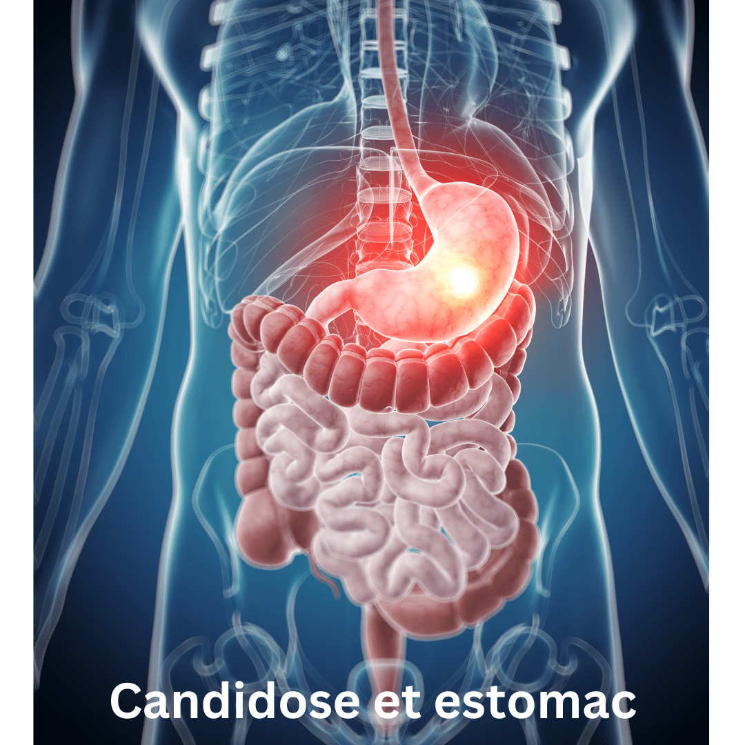 Candidose et estomac