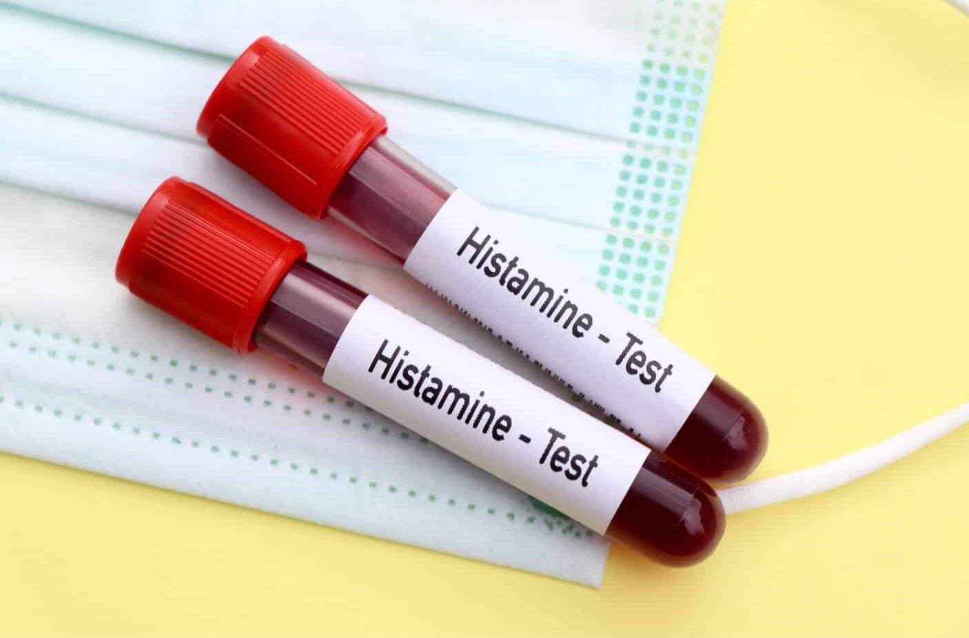 candidiasis histamina